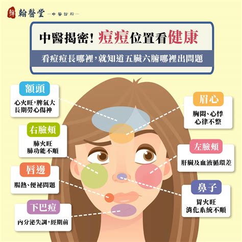 眉頭痘痘|痘痘長在下巴、眉心、嘴角代表身體警訊？看懂臉上長。